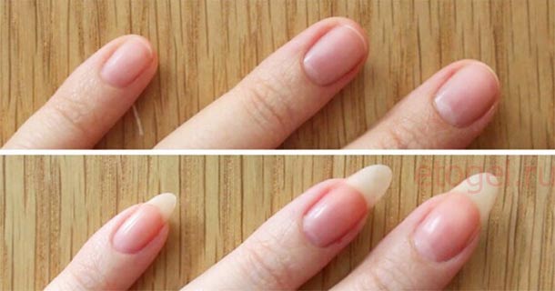 Что делать чтобы росли длинные ногти